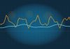 What Is Core Inflation, and Why Does the Federal Reserve Watch It? Abstract navy chart with a jagged gold line above a smoother cyan line, suggesting volatile headline prices versus a steadier core trend