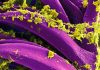 Russia Denies a Second Illness After Irkutsk Lab Worker Death Colorized micrograph of Yersinia pestis bacteria, not from the Irkutsk case.