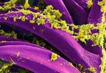 Russia Denies a Second Illness After Irkutsk Lab Worker Death Colorized micrograph of Yersinia pestis bacteria, not from the Irkutsk case.