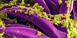 Russia Denies a Second Illness After Irkutsk Lab Worker Death Colorized micrograph of Yersinia pestis bacteria, not from the Irkutsk case.