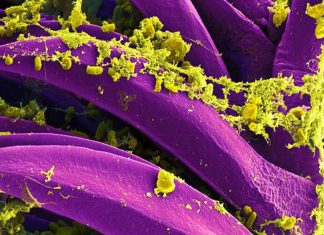 Russia Denies a Second Illness After Irkutsk Lab Worker Death Colorized micrograph of Yersinia pestis bacteria, not from the Irkutsk case.