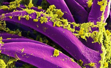 Russia Denies a Second Illness After Irkutsk Lab Worker Death Colorized micrograph of Yersinia pestis bacteria, not from the Irkutsk case.