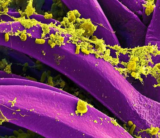 Russia Denies a Second Illness After Irkutsk Lab Worker Death Colorized micrograph of Yersinia pestis bacteria, not from the Irkutsk case.